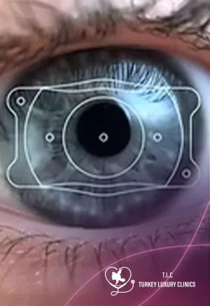 ICL Eye Surgery Cost 2026: EVO & Visian ICL Prices