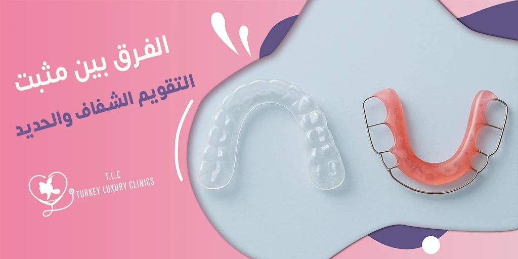 الفرق بين مثبت التقويم الشفاف والحديد: أيهما أفضل لك؟