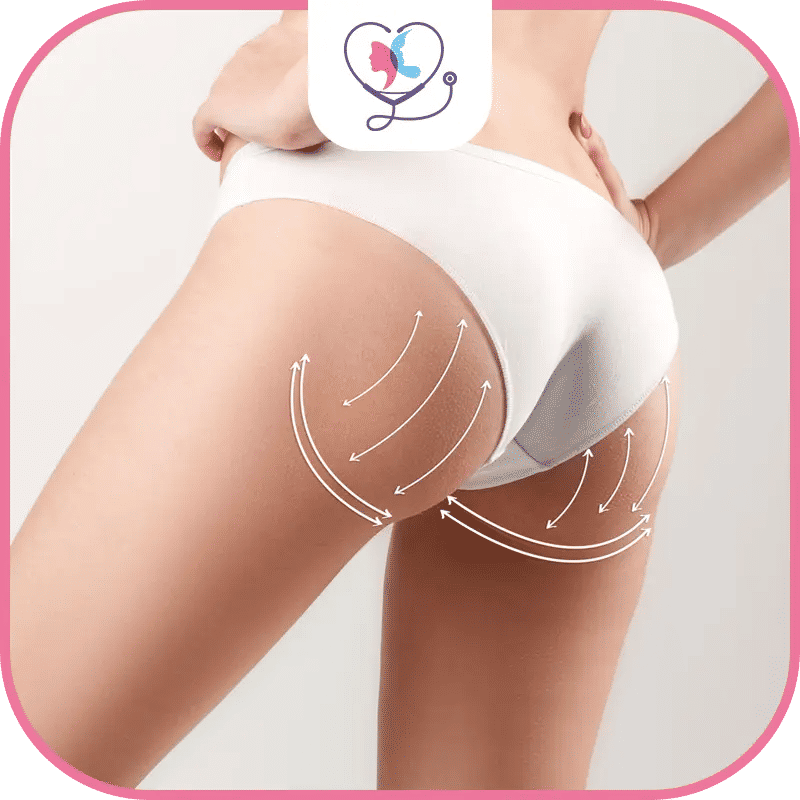 ما هي أسعار عملية شد ورفع المؤخرة في تركيا؟