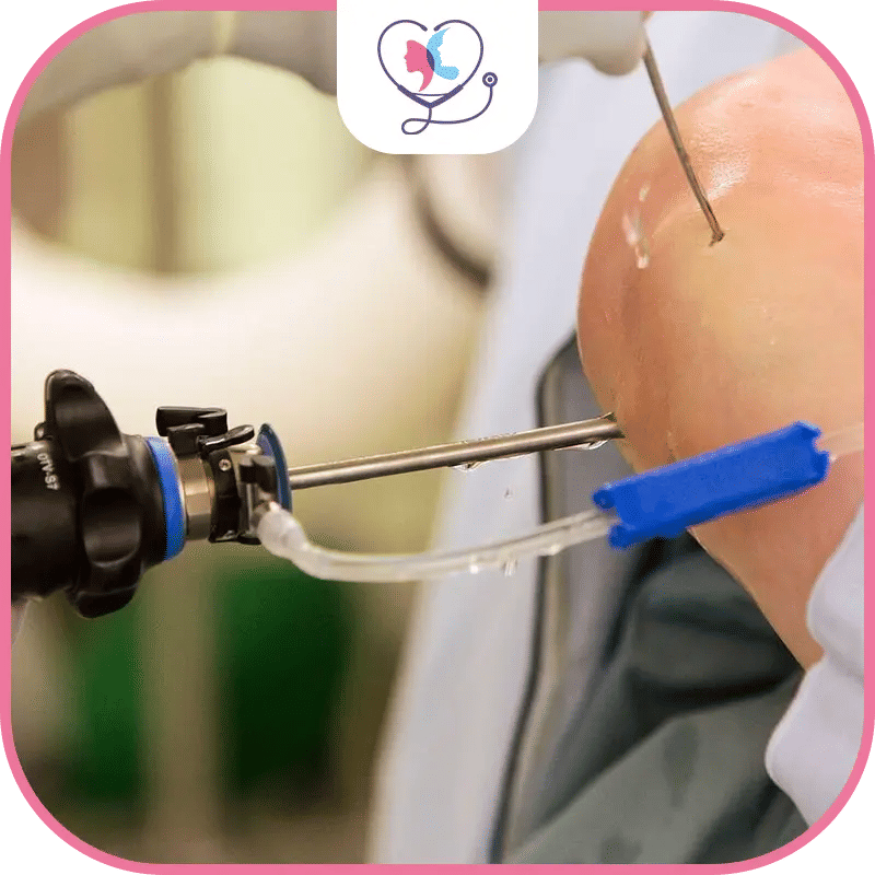 ما هي تكلفة تنظير مفصل الركبة في تركيا؟