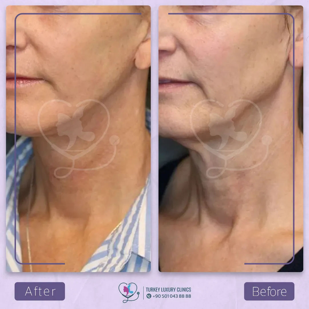 أسئلة يجب طرحها على الجراح قبل القيام بالعملية