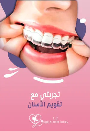 تجربتي مع تقويم الأسنان: نتائج حقيقية مع صور قبل وبعدfeatured image