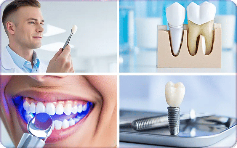 Hollywood Smile Design Types and Techniques