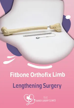 Fitbone Orthofix Beinverlängerung 2026featured image