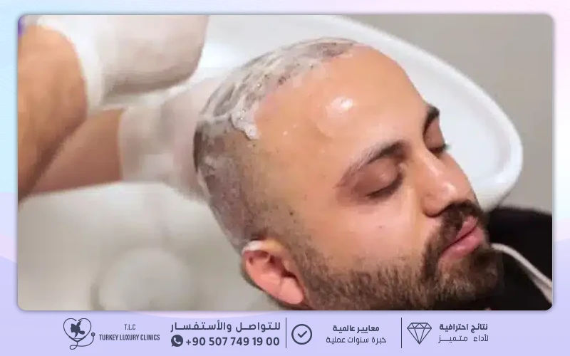 غسيل الشعر والمغادرة