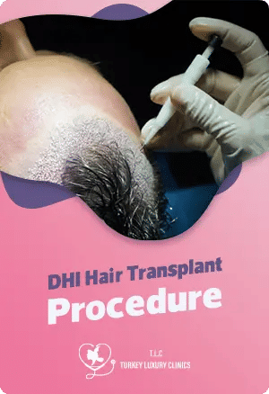 DHI Hair Transplant Procedure