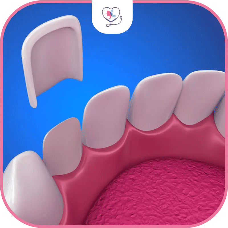 facettes dentaires turquie