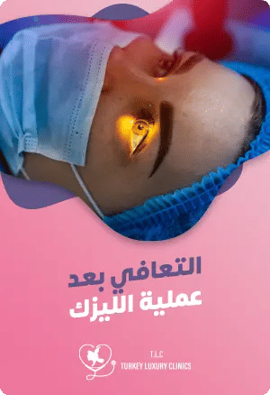 التعافي بعد عملية الليزكfeatured image