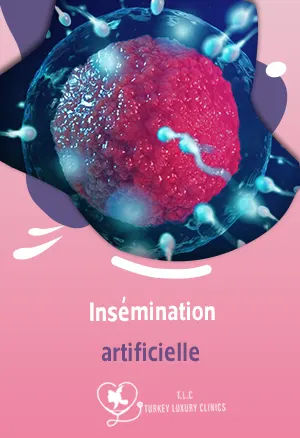 Insémination artificielle : avantages, limites et chances de réussite