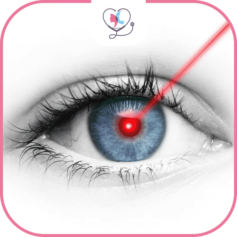 تصحيح النظر في تركيا