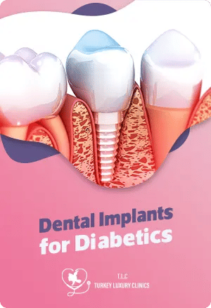 Dental Implants for Diabetics: Managing Risks for Successful Outcomes