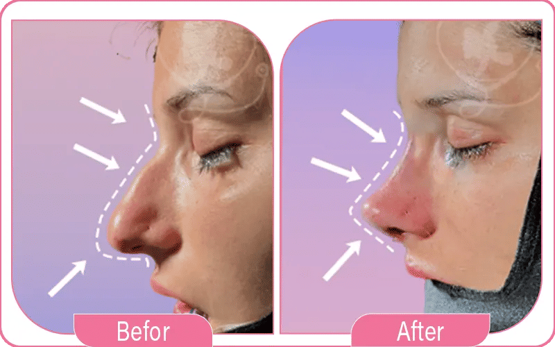 7. التدخين أو شرب الكحول