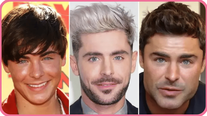 Zac Efron Face Changes