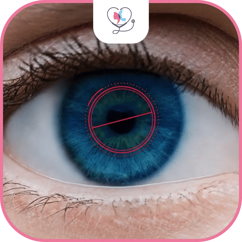 ماهي تكلفة عملية الفيمتو سمايل في تركيا؟