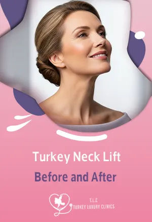 Turkey Neck Lift Before and After 2025 Photos & Transformations