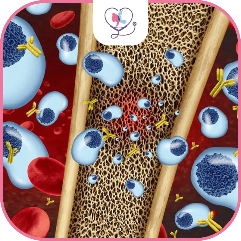 موانع عملية زراعة نخاع العظم