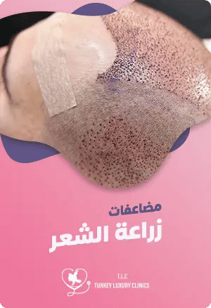 أهم مضاعفات عملية زراعة الشعر وكيفية تجنبهاfeatured image