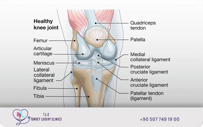 Healthy knee joint ligaments diagram showing quadriceps tendon, patella, articular cartilage, meniscus, collateral and cruciate ligaments, and patellar tendon structure