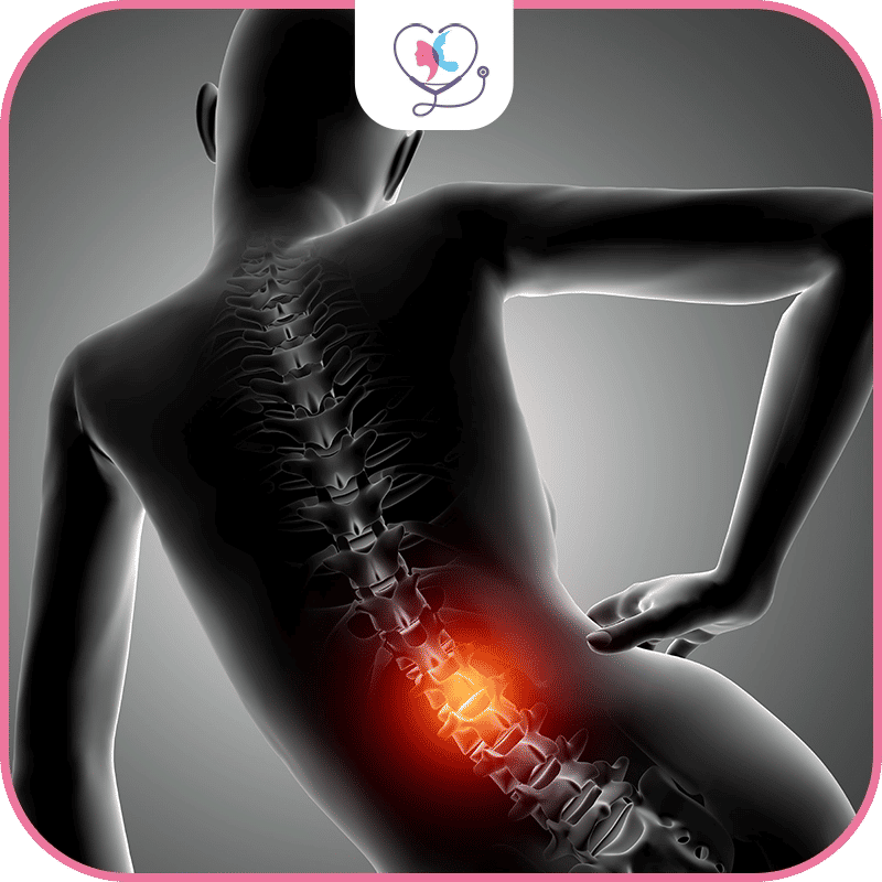 معايير اختيار أفضل دكتور للعمود فقري