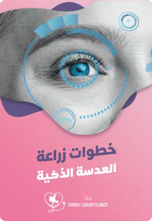 خطوات زراعة العدسة الذكية featured image