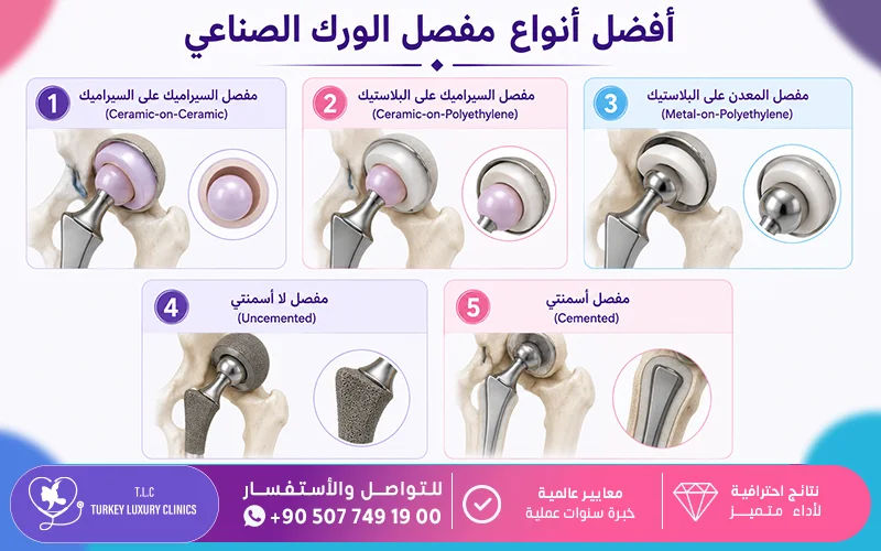 أفضل أنواع مفصل الورك الصناعي