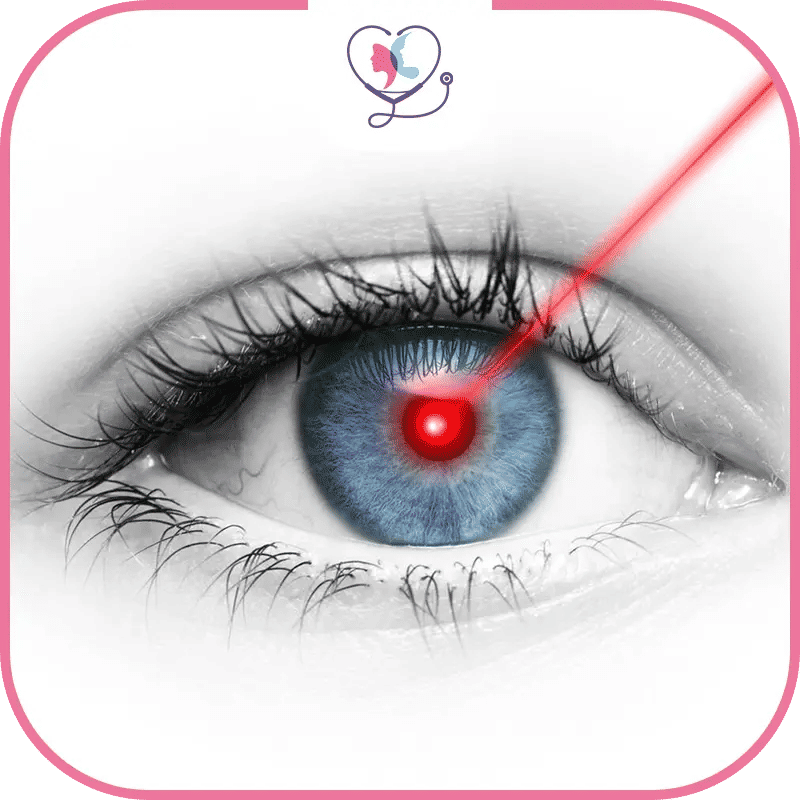 تصحيح الأخطاء الانكسارية في تركيا