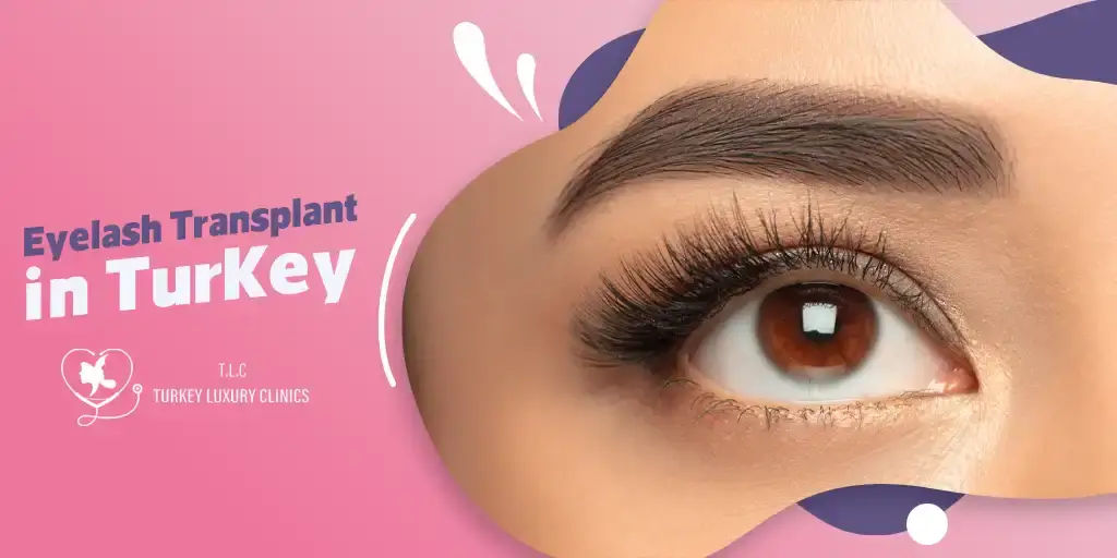 Eyelash Transplant in Turkey: Fuller, Natural-Looking Lashes