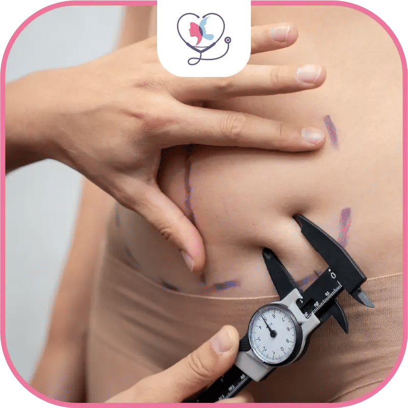 الفحوصات الطبية قبل شفط الدهون مع تركيا لاكشري كلينك