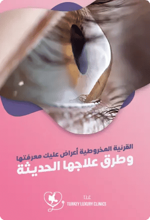 القرنية المخروطية: أعراض عليك معرفتها وطرق علاجها الحديثةfeatured image