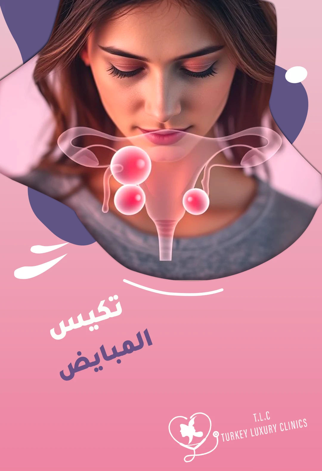 تكيس المبايض: الأعراض المبكرة والعلاجات الأكثر فاعلية لحالتك