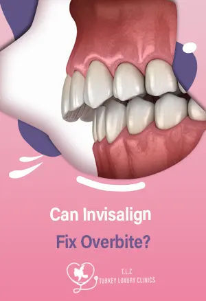 Может ли Invisalign исправить неправильный прикус?