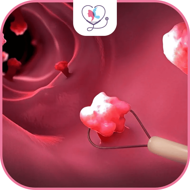 ما هو مستقبل جراحة الأورام؟