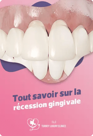 La récession gingivale – Causes, prévention et traitements