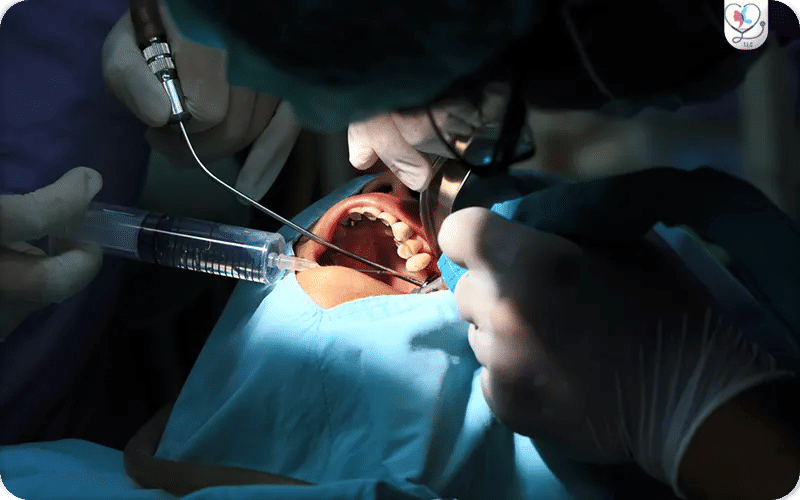 Qu’est-ce que la chirurgie maxillo-faciale ?