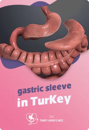 Gastric Sleeve in Turkey: The Comprehensive Guidefeatured image