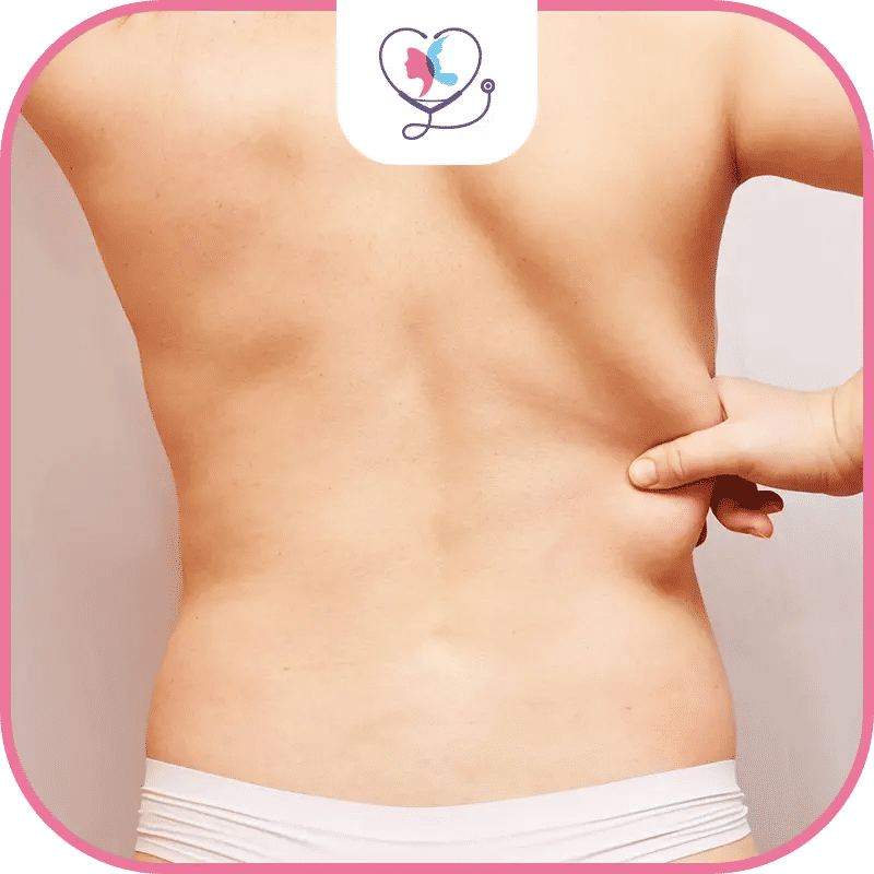 أولاً: شد الظهر العلوي