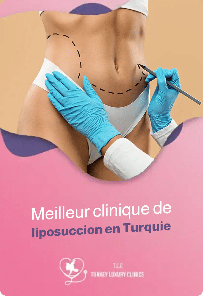 Meilleur clinique de liposuccion en Turquie 2026: guide complet