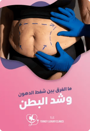 ما الفرق بين شفط الدهون وشد البطن؟featured image