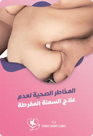 السمنة المفرطة: المخاطر والوقاية والعلاجfeatured image