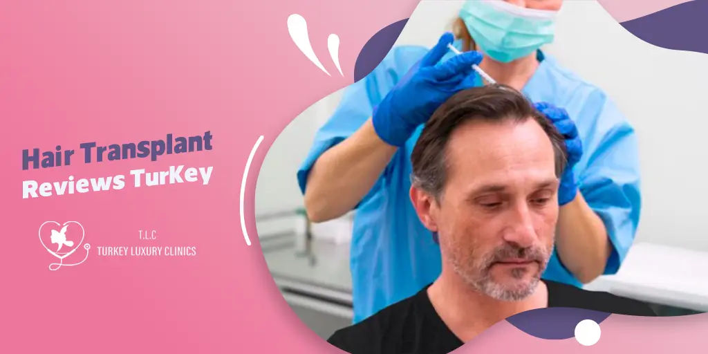 Hair Transplant Reviews Turkey