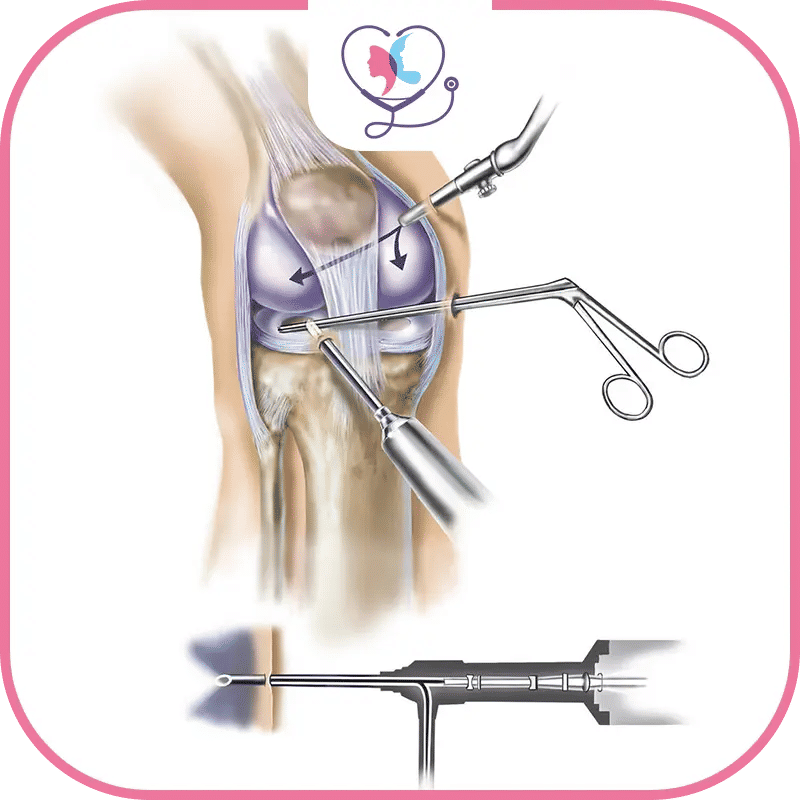 متى تكون عملية تغيير مفصل الركبة ضرورية؟
