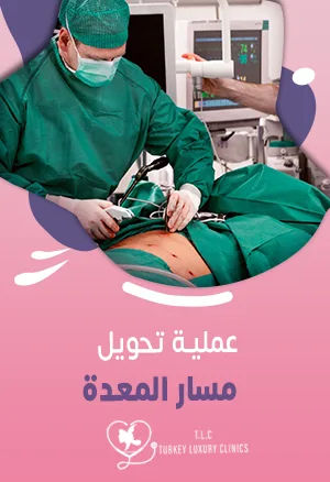 عملية تحويل مسار المعدة: الأنواع والتكلفة ونسبة نزول الوزن