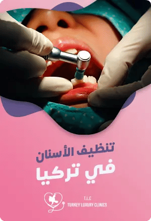 تنظيف الأسنان في تركياfeatured image