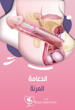 الدعامة المرنة: المميزات والعيوب والأسعار