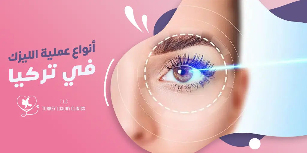 أنواع عملية الليزك في تركيا