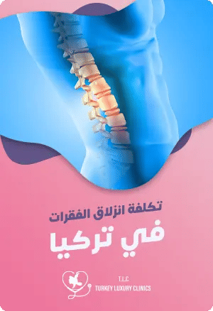 تكلفة جراحة انزلاق الفقرات في تركياfeatured image