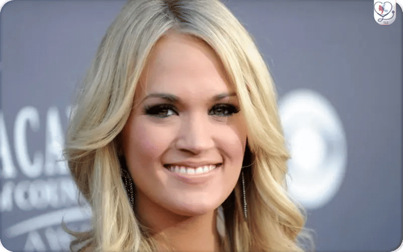 Carrie Underwood Plastic Surgery Accident 2017