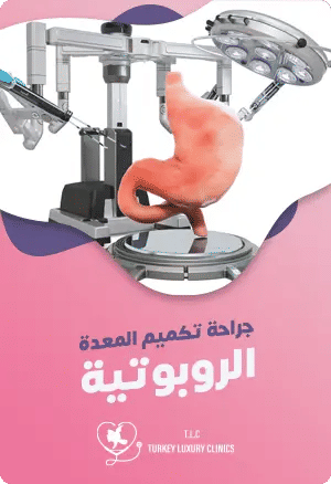 تكميم المعدة الروبوتي: تقنية حديثة لإنقاص الوزن بأمانfeatured image