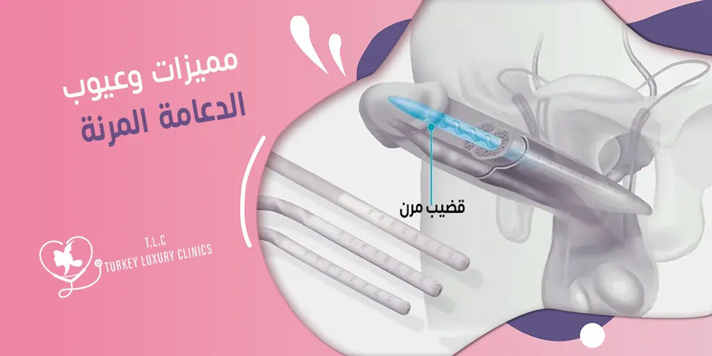 مميزات وعيوب الدعامة المرنة