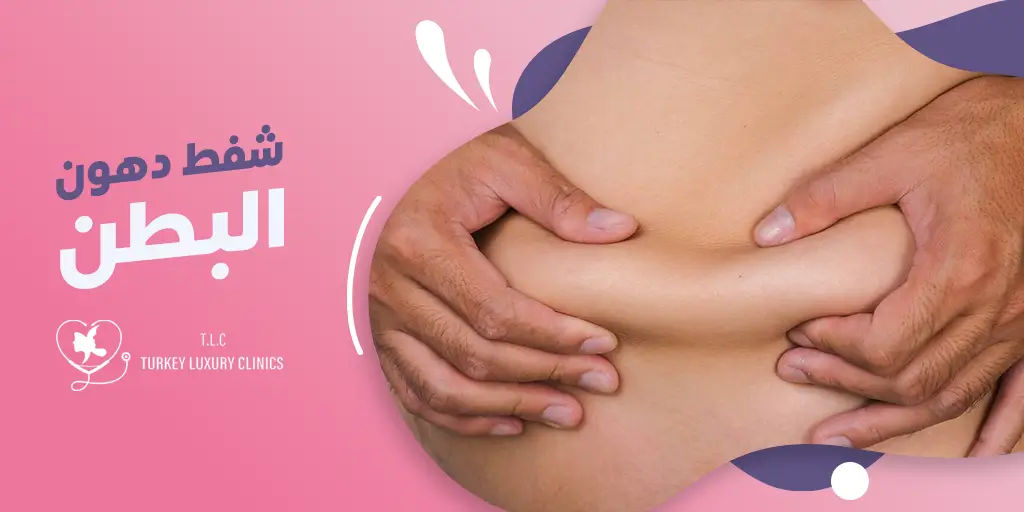  شفط دهون البطن